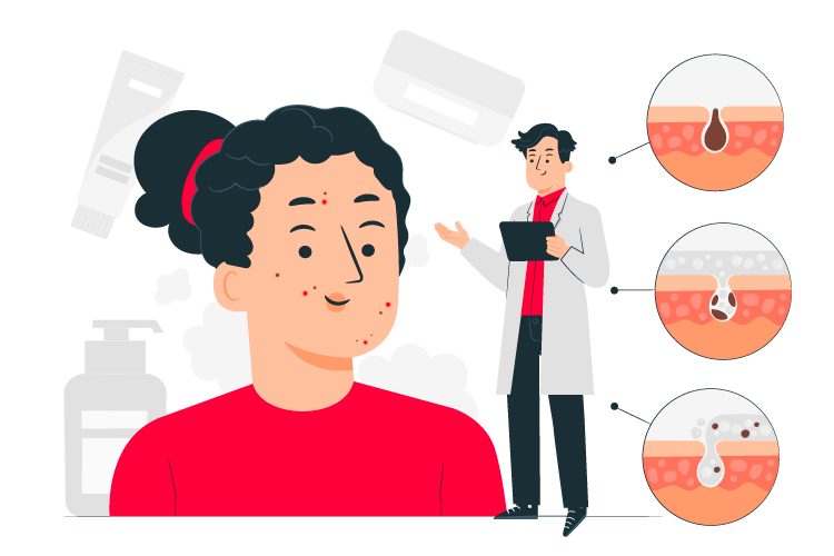 acne treatment online